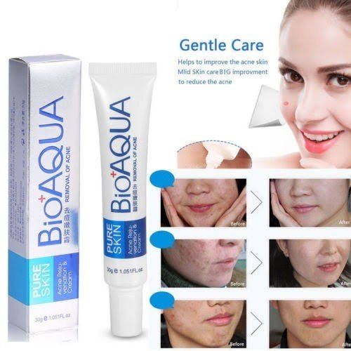 BIOAQUA Acne & Scar Removal Face Cream (30g)